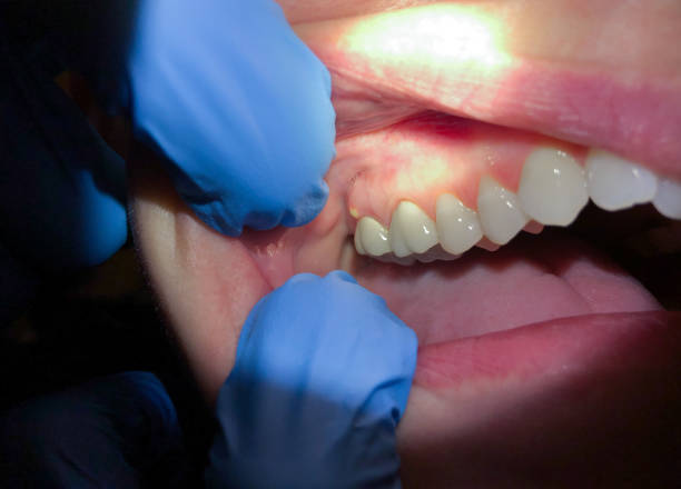 Best Broken Tooth Emergency  in Arden On The Severn, MD